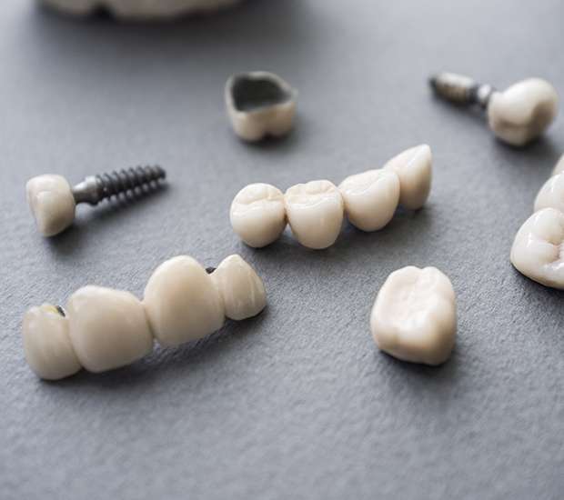 Babylon The Difference Between Dental Implants and Mini Dental Implants
