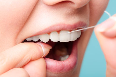 What To Expect After Getting Dental Fillings